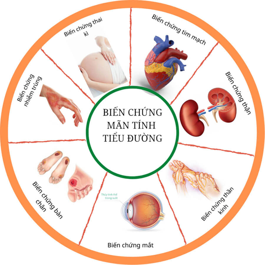 biến chứng bệnh tiểu đường