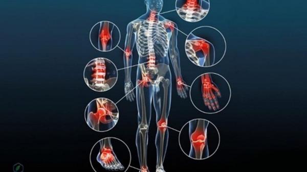 Thoái hóa khớp có giới hạn độ tuổi?