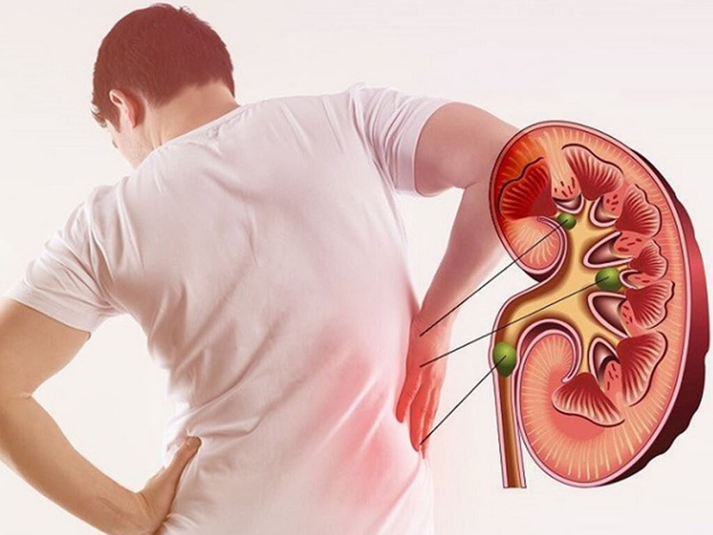 Vì sao ngày càng nhiều người trẻ đối mặt với nguy cơ suy thận?